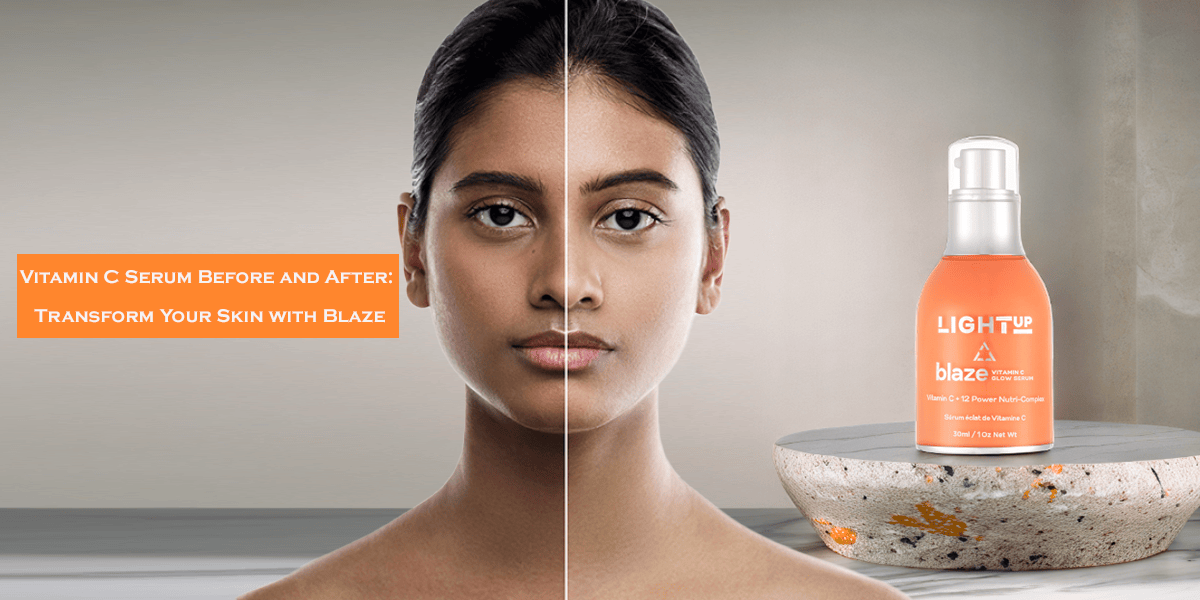 Vitamin C Serum Before and After: Transform Your Skin