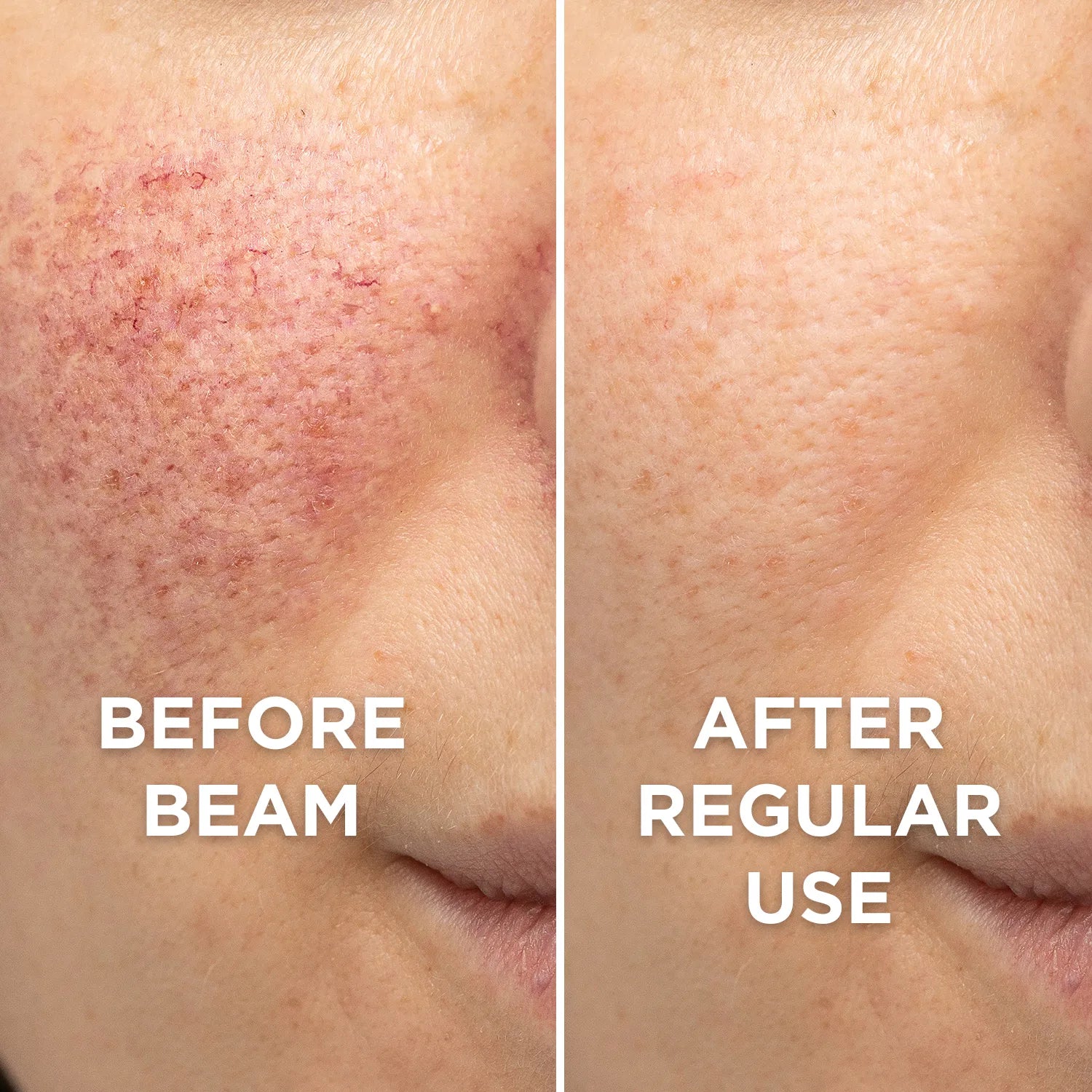 Before and after usage of beam clay mask