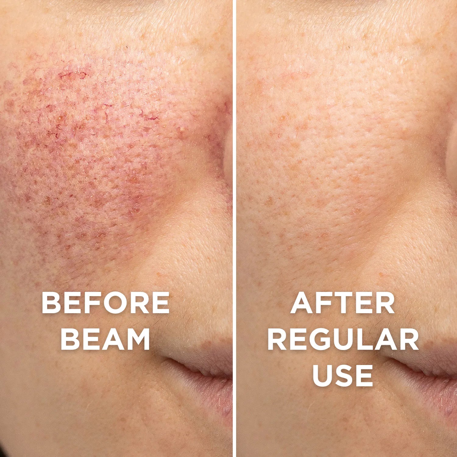 Before and after usage of beam clay mask