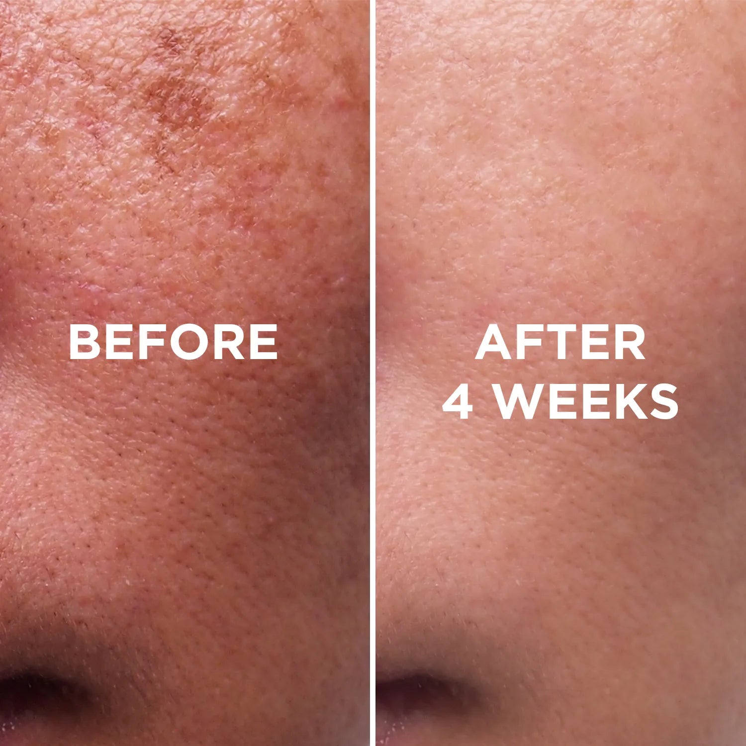 BLAZE Vitamin C Glow Serum