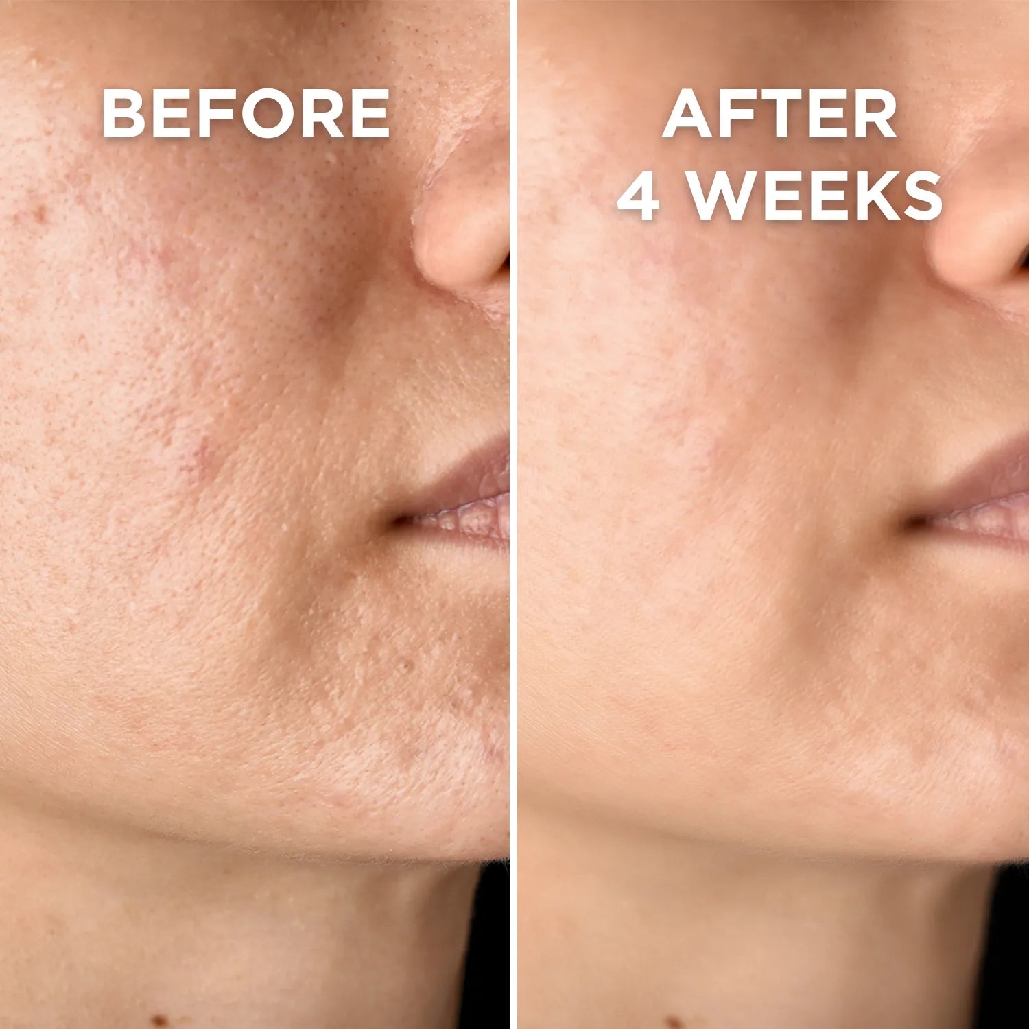 Before and after results of using Prism best face creams for glowing skin