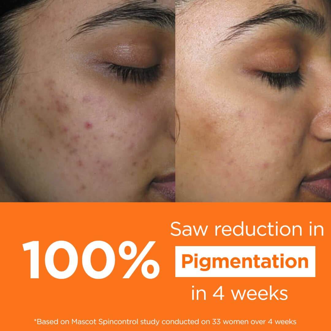 before and after usage of face glow cream - PRISM