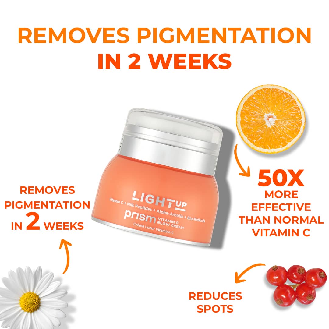 prism face glow cream removes pigmentation in two weeks
