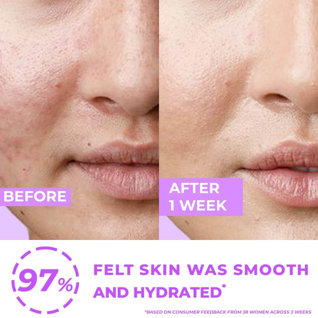 before and after use of hydrating face serum